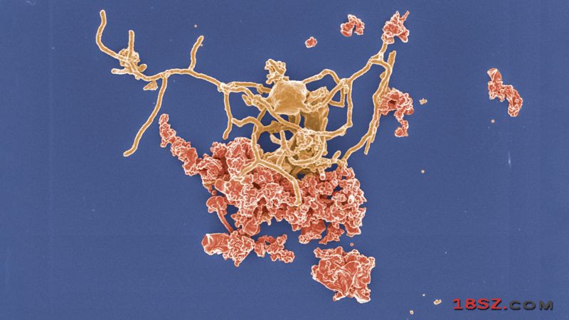 科学家历时12年培育出深海古菌。图片来源：美国《科学》杂志官网