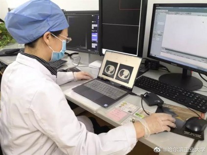 哈尔滨研发CT图像自动分析系统 判读新冠肺炎快30倍