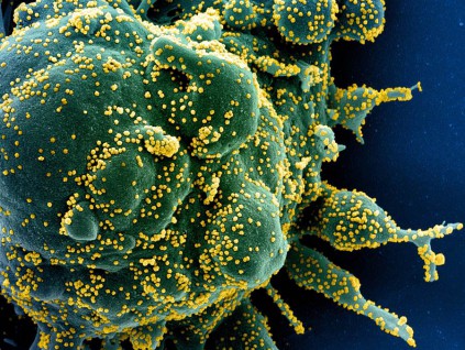 英国剑桥研究：新冠病毒有3类 在武汉已突变为B型