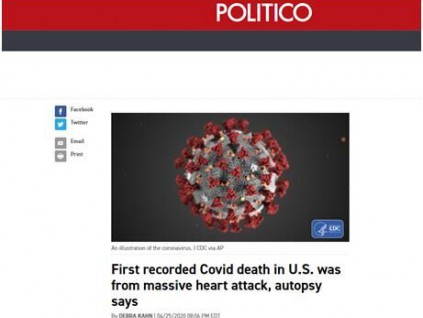 美国第一例新冠死亡病例尸检：心脏受压破裂导致死亡