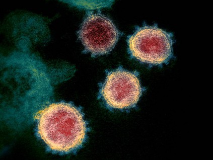 最新基因分析：新冠病毒去年底已全球传播