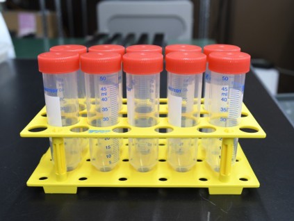 日本研发出唾液检测新冠病毒试剂 短时间内出结果
