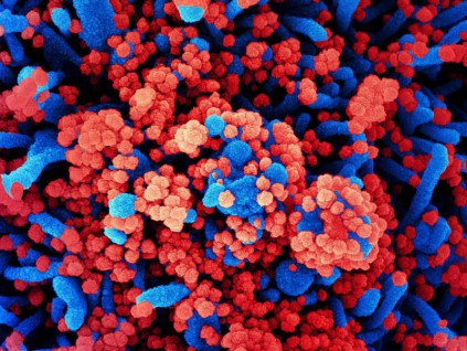 英国牛津大学开发快速新冠病毒检测方法