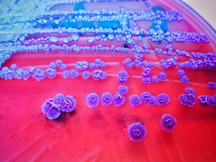 美国惊现罕见致命热带细菌 4人神秘染病已2死