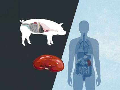 器官移植新突破 纽大医学院完成猪肾移植人类