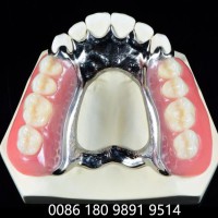 法国义齿实验室 假牙工厂 |隐形全口义齿|种植牙|活动义齿
