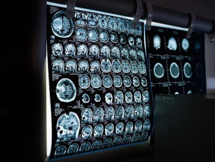 以色列大学最新研究 揭示大脑注意力切换机制