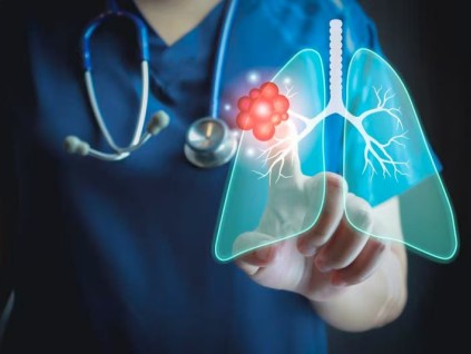 澳大利亚一项新研究：血液蛋白或能提早预示肺癌风险